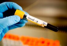 20 новозаразени с коронавирус в пловдивско