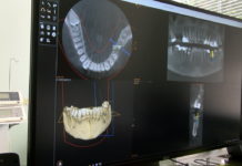Как съвременните технологии помагат на денталната медицина