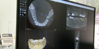 Как съвременните технологии помагат на денталната медицина