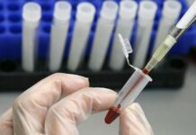 Въвеждат технология за изследване на кръвта на световно ниво