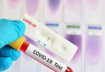 От днес антигенните тестове се приравняват на PCR-ите