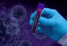 28 са новите случаи на COVID-19 в Асеновград