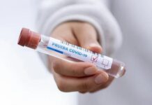 458 са новите случаи на COVID-19 в областта