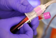 Областният управител Дани Каназирева призова пловдивчани и жителите на областта да дарят кръвна плазма