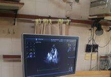 Нова апарат за профилактика и диагностика на сърдечни заболявания получи МБАЛ – Асеновград