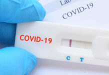 Родители декларират до утре на обяд съгласни ли са да тестват децата бърз антигенен тест