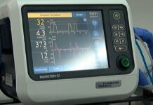 Нов обдишващ апарат в МБАЛ, 10 000 лв. за него – дарение от служител на болницата