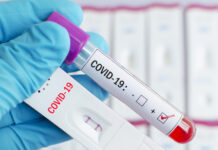 Значителен спад на заразените с Ковид-19 у нас