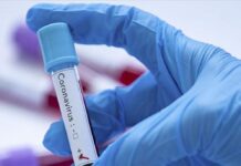 Лекар от Асеновград е сред новорегистрираните случаи с COVID-19 на територията на областта