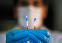 43 нови случая на COVID-19 в областта