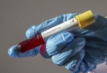 182 са новорегистрираните с корона вирус у нас за последните 24 часа