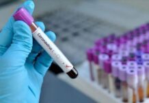 Общият брой на заразените с COVID-19 в Асеновград е 342