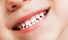 Кампания „Моето зъбче – здраво и силно“ в Асеновград