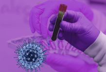 Трима новозаразени с коронавирус в Асеновград, най-възрастният е на 88 години