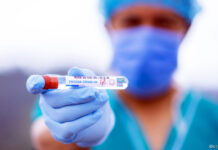 209 новозаразени с Ковид-19 в Пловдив