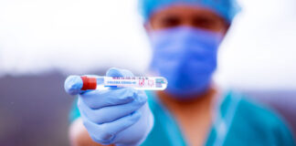 Пловдив отново сред водещите градове с най-много нови случаи на COVID 19