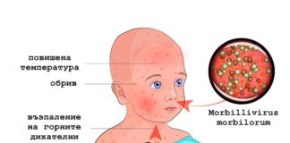 Министерството на здравеопазването призовава да ваксинираме децата си против морбили