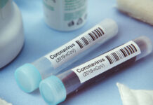 Очакват резултатите на 18 пациенти в Пловдив със съмнение за коронавирус