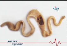 Мисия здраве 18.01.2017