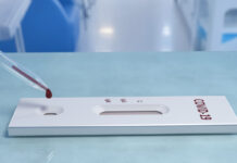 От понеделник започва изследване за ковид с бързи антигенни тестове на всички учители в областта