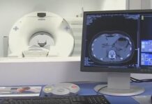 МБАЛ Асеновград ще изплаща на вноски новия скенер