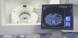 МБАЛ Асеновград ще изплаща на вноски новия скенер