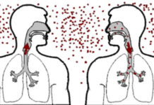 Днес се отбелязва Световният ден за борба с туберколозата