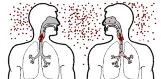 Днес се отбелязва Световният ден за борба с туберколозата